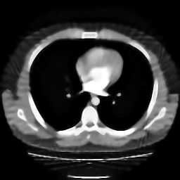 Hasil Akhir Restorasi Citra CT Scan Thorax